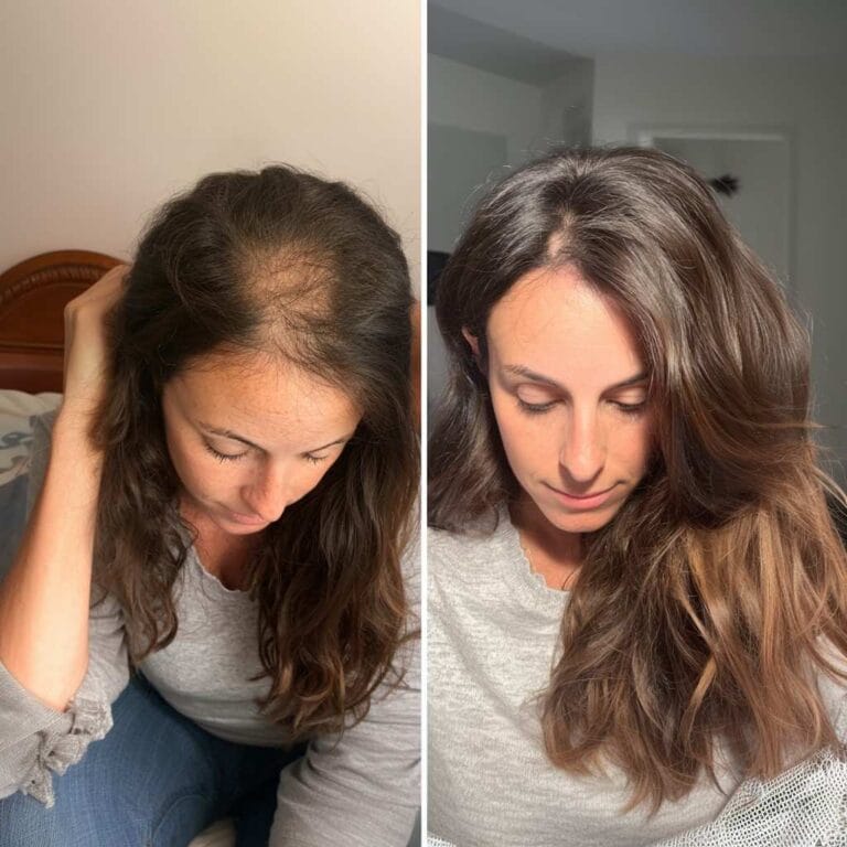 7 Shocking Hair Care Mistakes Women Make That Cause Hair Loss 7 shocking hair care mistakes women make That Cause Hair Loss