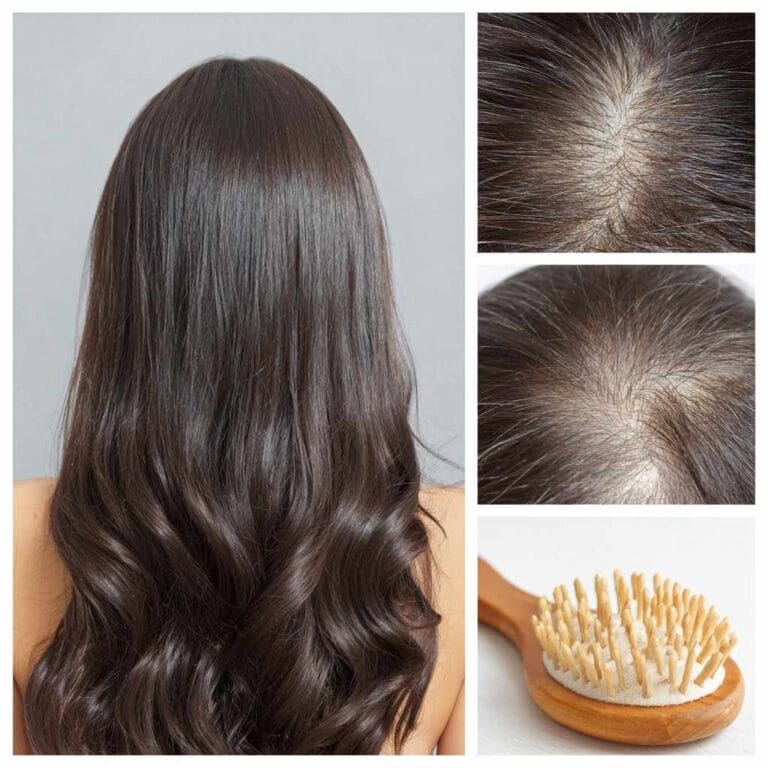 Shampoos for Hair Loss