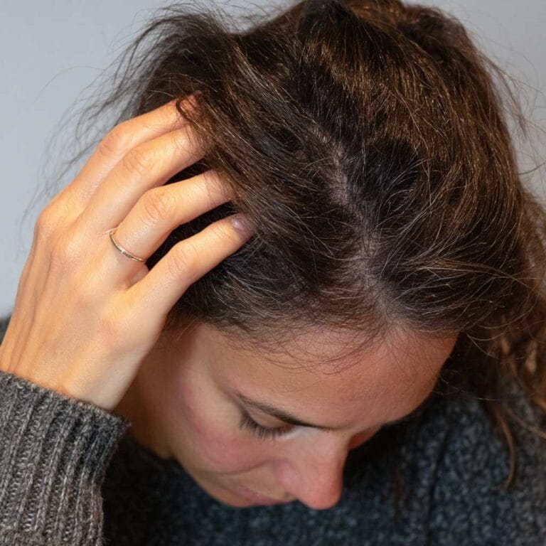 7 Dry Scalp Treatments